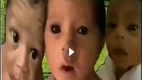 Vaccine Genocide - NEW Footage Of Black Eyed Hybrid Pandemic Babies