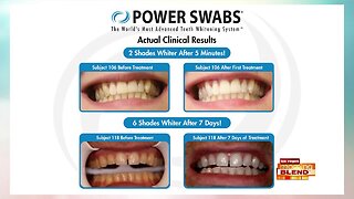 Whiten Your Smile With Power Swabs