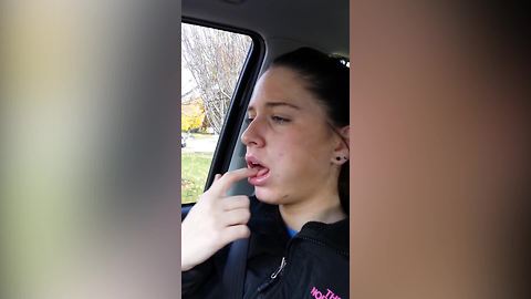 A Teen Girl Can’t Feel Her Tongue After Having Her Wisdom Teeth Removed