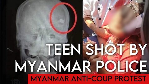 Myanmar teen shot in head during police crackdown [WARNING:Graphic Content]