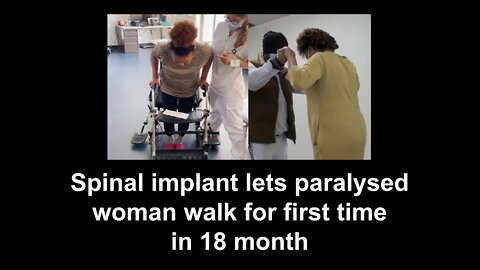 Spinal implant lets paralysed woman walk for first time in 18 month