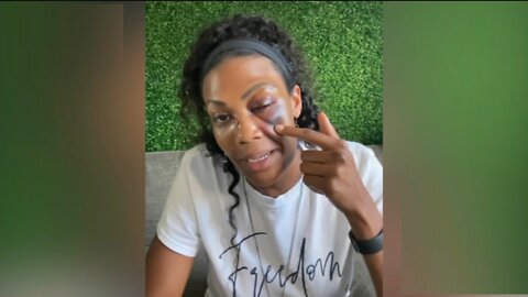 Reaction to Kim Glass Attacked in LA. Former Volleyball Olympian.