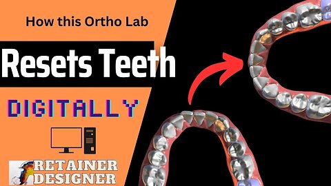 How This Orthodontic Lab Straighten Teeth: Digitally!