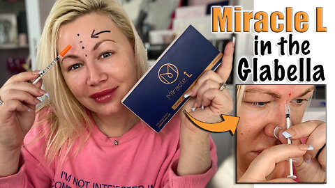 Fixing my Forehead: Miracle L in the Glabella from Acecosm.com | Code Jessica10 Saves you Money!