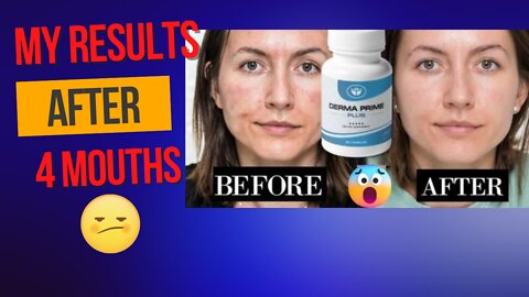 Derma Prime Plus Reviews 2022 My Honest Opinion