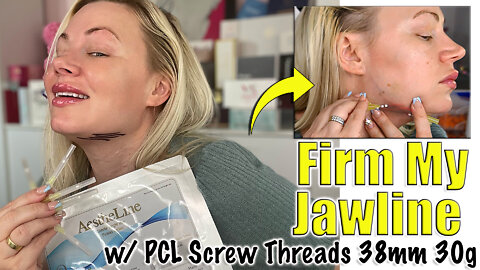 Firm my Jawline with PCL Screw threads from AceCosm.com | Code Jessica10 Saves you Money!