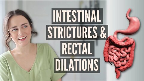 Strictures & Dilations with IBD | Let's Talk IBD