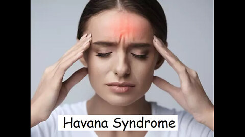 havanah syndrome - voice to skull how it works