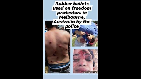 המשטרה באוסטרליה פוגעת קשות באזרחים שעוברים על תו ירוק מסכות מפגינים