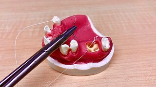The #1 Dental Surgery Tip (It’s Not What You Think)