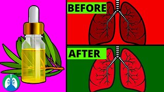 How to Cleanse Your Lungs with Tea Tree Oil