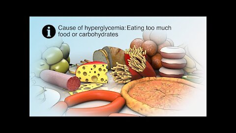 Treating High Blood Sugar | Hyperglycemia | Nucleus Health