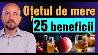 Oțetul de mere și sănătatea - 25 de beneficii