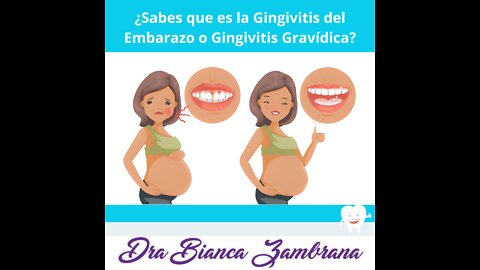 ¿Qué es la Gingivitis del Embarazo?