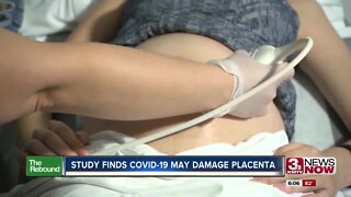 Study Finds COVID-19 May Damage Placenta