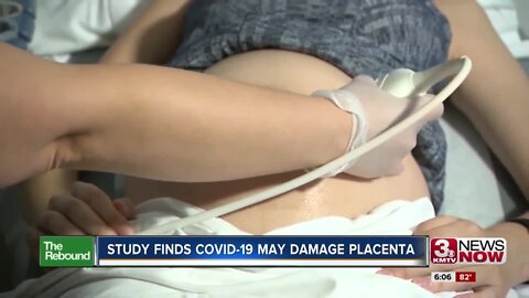 Study Finds COVID-19 May Damage Placenta