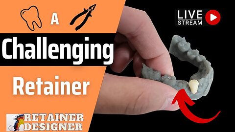 Live Stream: A Challenging Lower Retainer