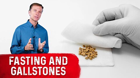 Fasting and Gallstones