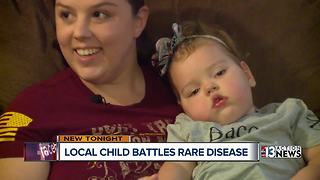 Family raising money to help child with rare genetic disease