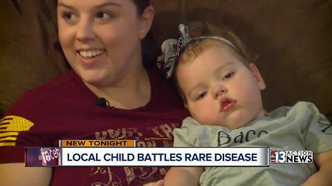 Family raising money to help child with rare genetic disease