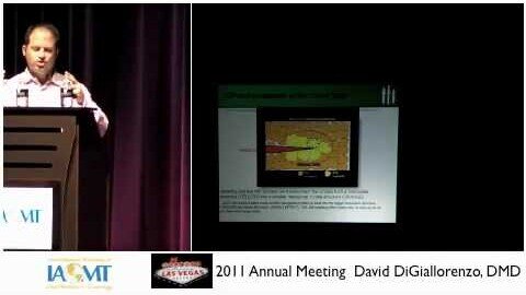 David DiGiallorenzo, DMDspeaks about Zirconium Dioxide Implants IAOMT 2011 Las Vegas