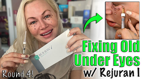Fixing Old Under Eyes with Rejuran I, Round 4 from AceCosm.com | Code Jessica10 Saves you Money!