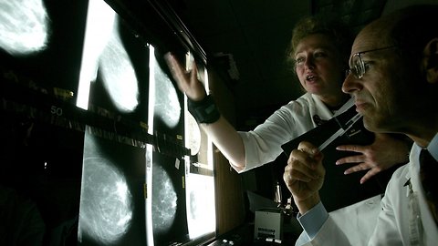 Genetic Breast Cancer Testing Guidelines May Lead To Missed Cases