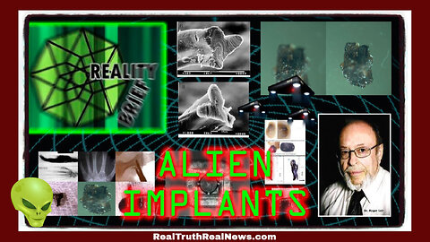 👽 Are We Being Implanted With Technology From a Species That is Not Human? Scary Sh!t if True * Info Links 👇
