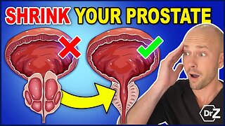 How To Fix An Enlarged Prostate - Shrink YOUR Prostate