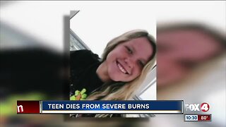 Layne Chesney, teen who was badly burned in bonfire, dies at 15