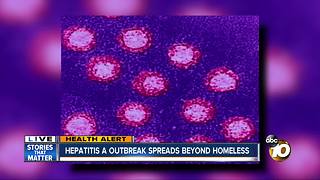 Hepatitis A outbreak spreads beyond homeless community