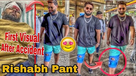 After Injury First Visual Of Rishabh Pant Best Wicket Keeper & Batsman Spotted at Mumbai Airport