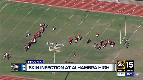 High school football game canceled due to skin infection