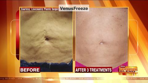 A New Treatment Improving a Variety of Cosmetic Issues