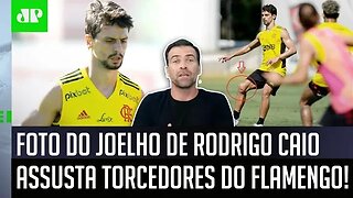 "É BEM ASSUSTADOR!" JOELHO de Rodrigo Caio volta a CHAMAR A ATENÇÃO no Flamengo!