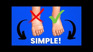 Simplest Ways To Stop Ankle Swelling & Pain