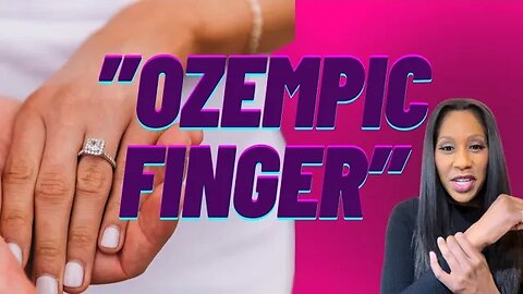 What is “Ozempic Finger?” 😮 A Doctor Explains