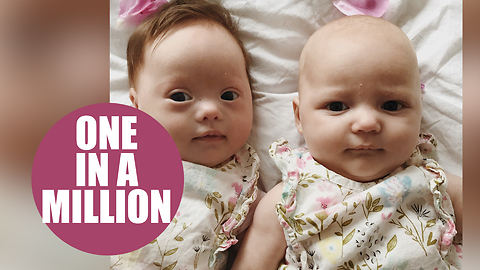 Meet the 'one in a million' twins - one with Down's syndrome and the other without