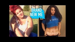 I Lost 200lbs But Felt Trapped In My Excess Skin | BRAND NEW ME