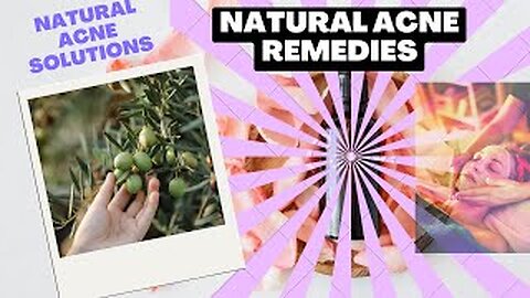 Natural Acne Remedy || Remove Acne Fast and Easy With These Home Remedies