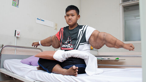 'World’s Heaviest Kid' Has Saggy Skin Surgery | TRULY