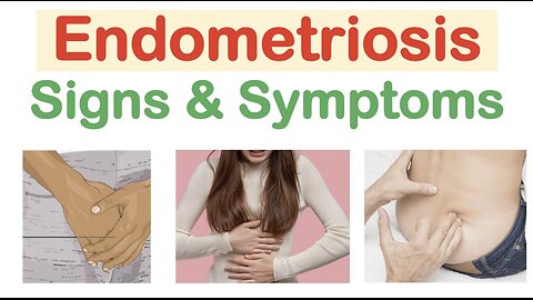 Endometriosis Signs & Symptoms (& Why They Occur)