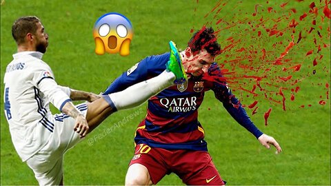 FIGHT IN BETWEEN MATCH VERY BAD FIGHT IN FOOTBALL HISTORY ⚽⚽⚽⚽