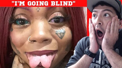 MOM TATTOOED HER EYEBALLS, BUT NOW SHE CAN'T SEE