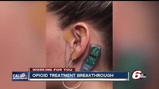 Device to reduce opioid withdrawal symptoms approved by FDA