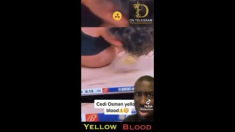 NBA player bleeds “yellow” blood 🩸