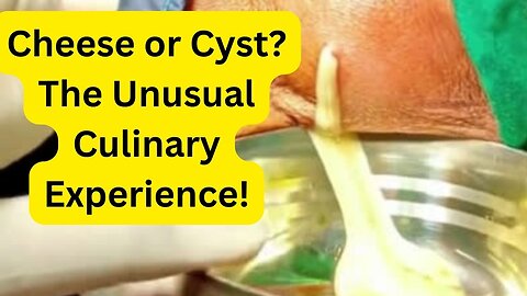 Cheese or Cyst? The Unusual Culinary Experience!