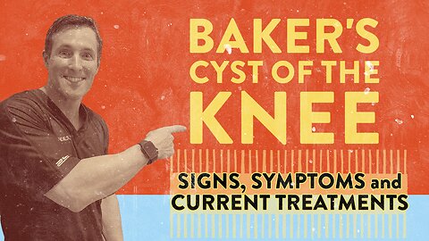 Baker's cyst of the knee: Signs, symptoms and current treatments