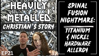 EP21 - Spinal Fusion Nightmare: Titanium & Nickel Allergy + Surgical Clips