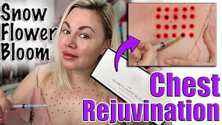 Chest Rejuvination with Snow Flower Bloom! Maypharm.net: Code Jessica10 Saves you Money